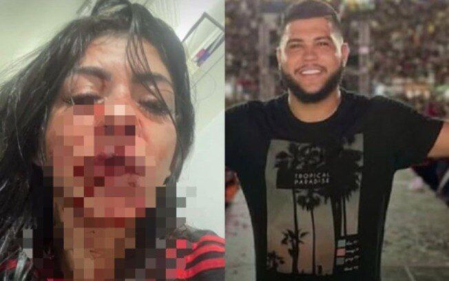 COM MEDO DE SER MORTA - Após ter dentes quebrados,mulher retira a queixa contra cantor
